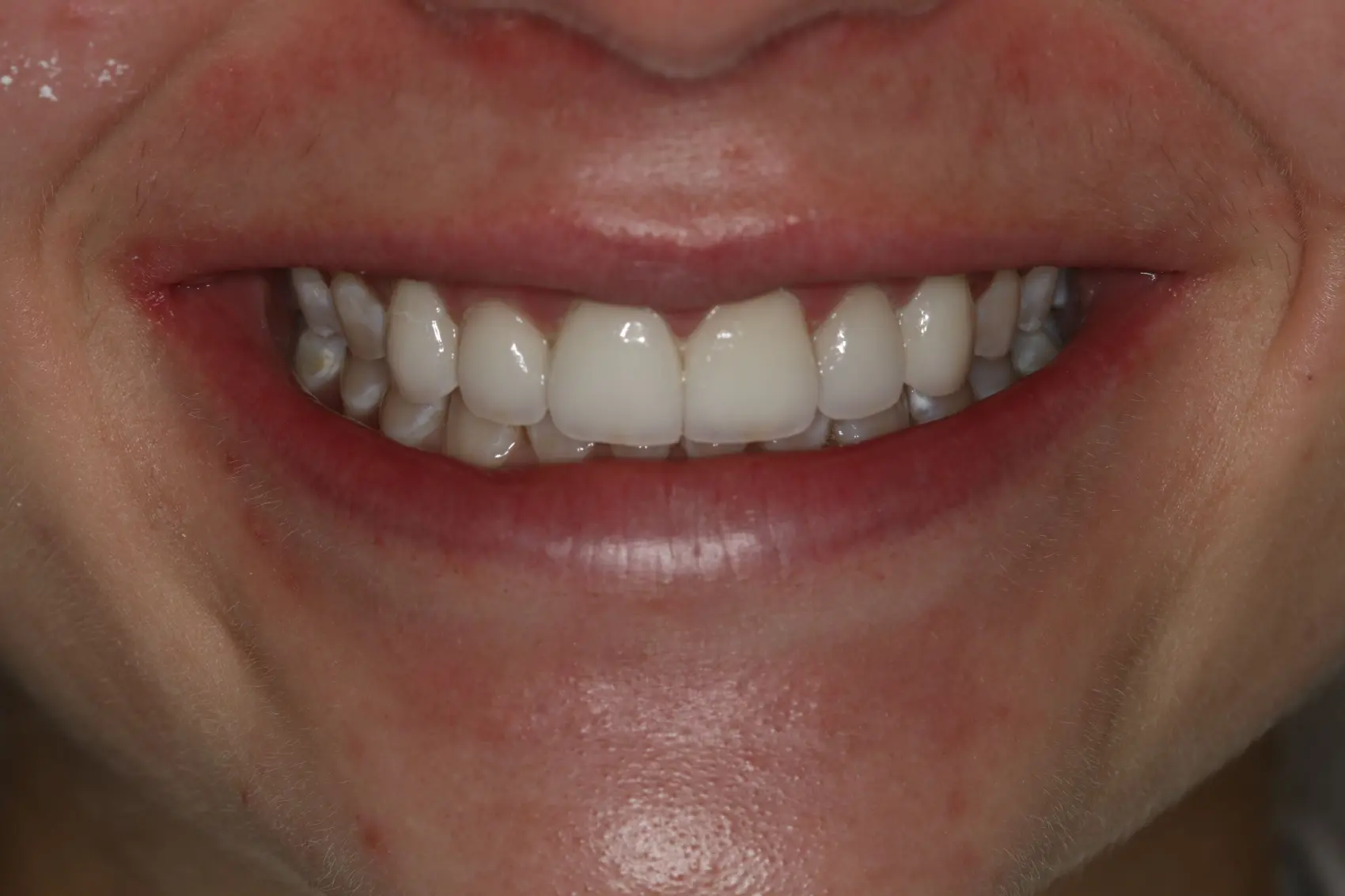 Georgetown Cosmetic Dentistry Georgetown Cosmetic Dentistry