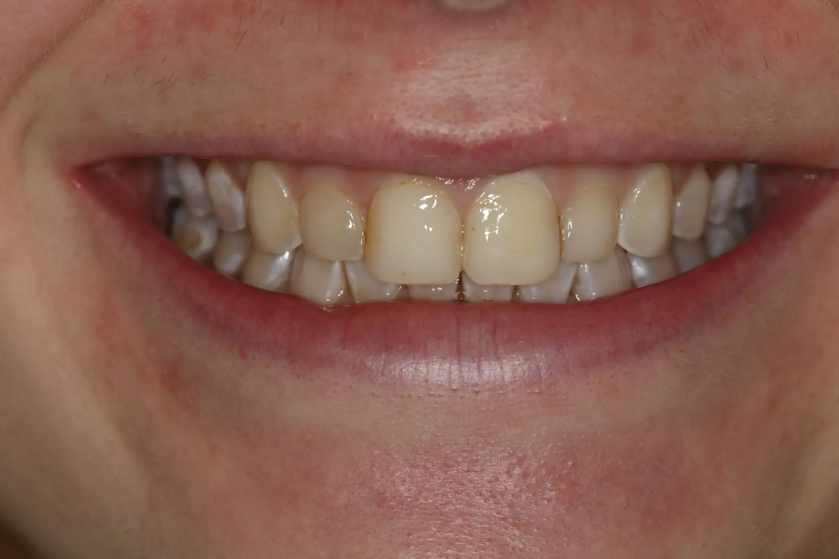 Georgetown Cosmetic Dentistry Georgetown Cosmetic Dentistry