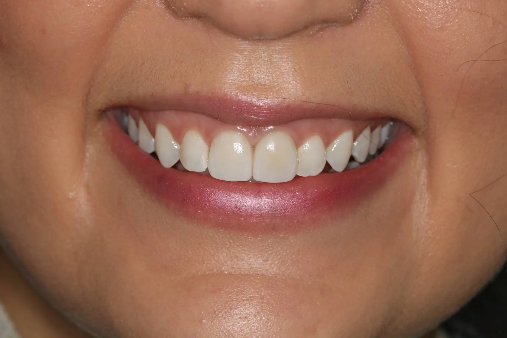 Georgetown Cosmetic Dentistry Georgetown Cosmetic Dentistry