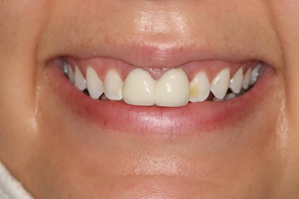 Georgetown Cosmetic Dentistry Georgetown Cosmetic Dentistry