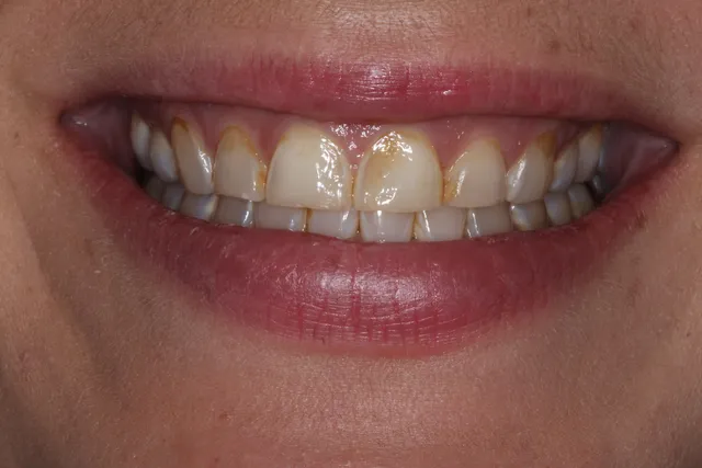 Georgetown Cosmetic Dentistry Georgetown Cosmetic Dentistry