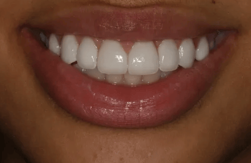 Georgetown Cosmetic Dentistry Georgetown Cosmetic Dentistry