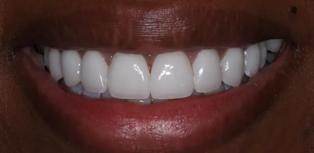 Georgetown Cosmetic Dentistry Georgetown Cosmetic Dentistry