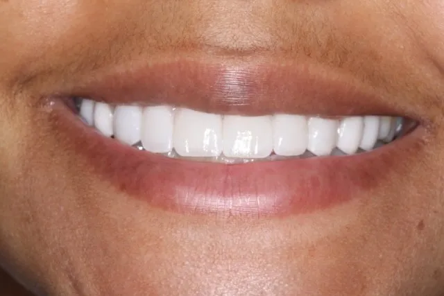 Georgetown Cosmetic Dentistry Georgetown Cosmetic Dentistry
