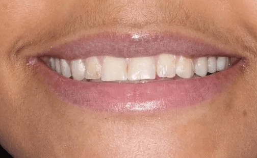 Georgetown Cosmetic Dentistry Georgetown Cosmetic Dentistry