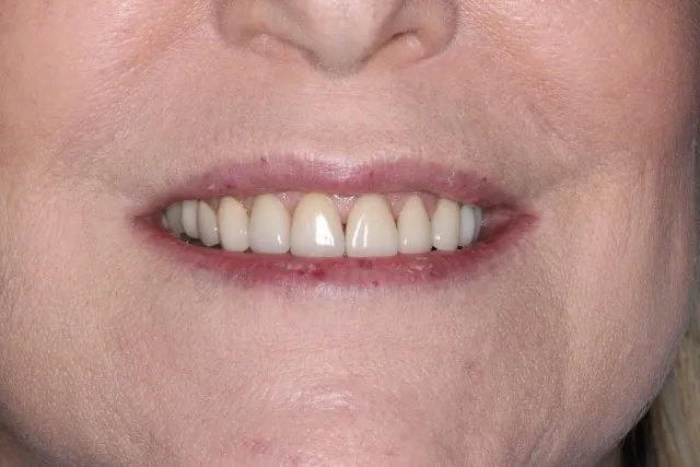 Georgetown Cosmetic Dentistry Georgetown Cosmetic Dentistry