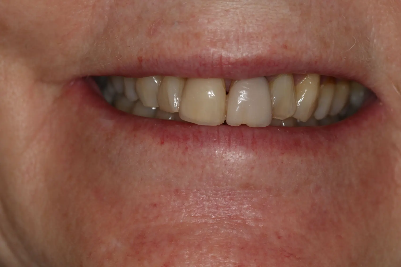 Georgetown Cosmetic Dentistry Georgetown Cosmetic Dentistry