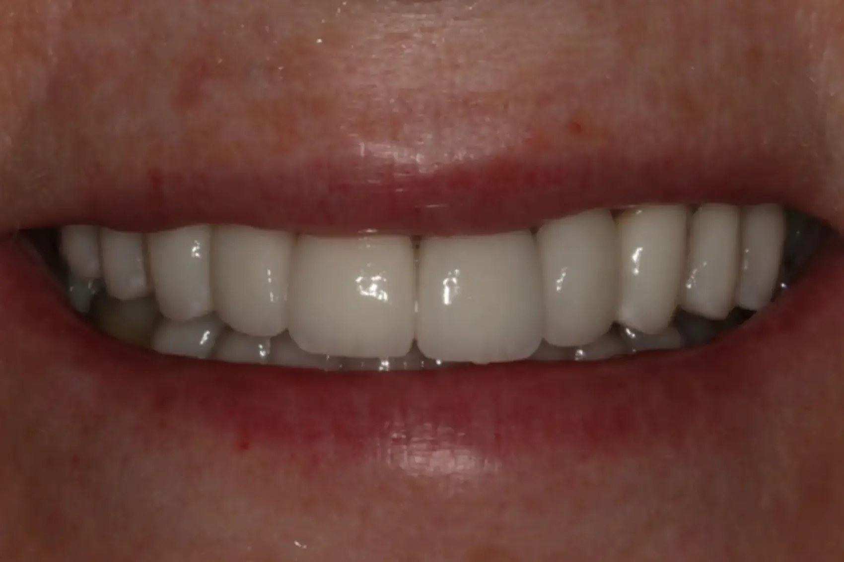 Georgetown Cosmetic Dentistry Georgetown Cosmetic Dentistry