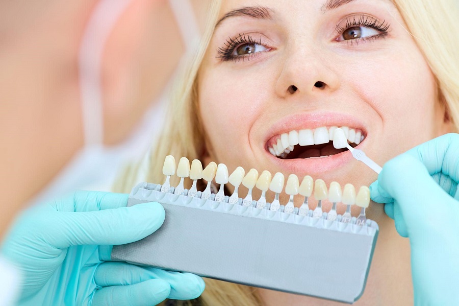 How to Care For Your Veneers?