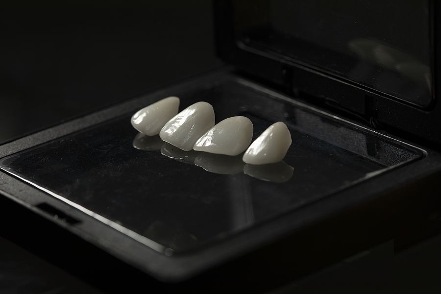 Transform Your Smile with Porcelain Veneers in Washington, DC